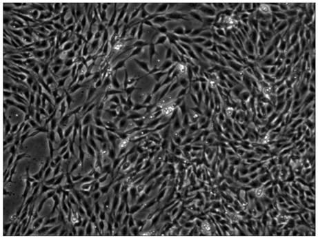 Extraction reagent and extraction method of human autologous stromal vascular fractions SVF