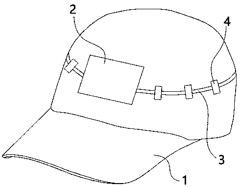 Adaptive protection helmet for skull defect patient