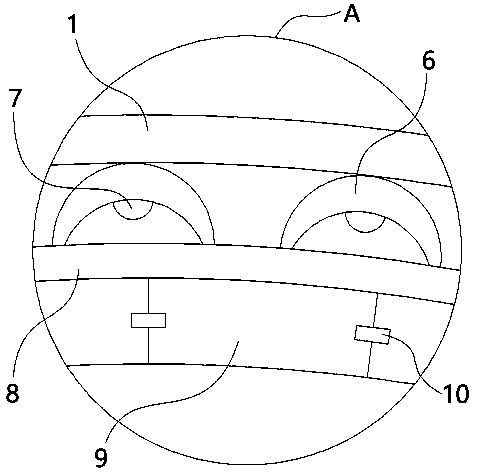 Adaptive protection helmet for skull defect patient