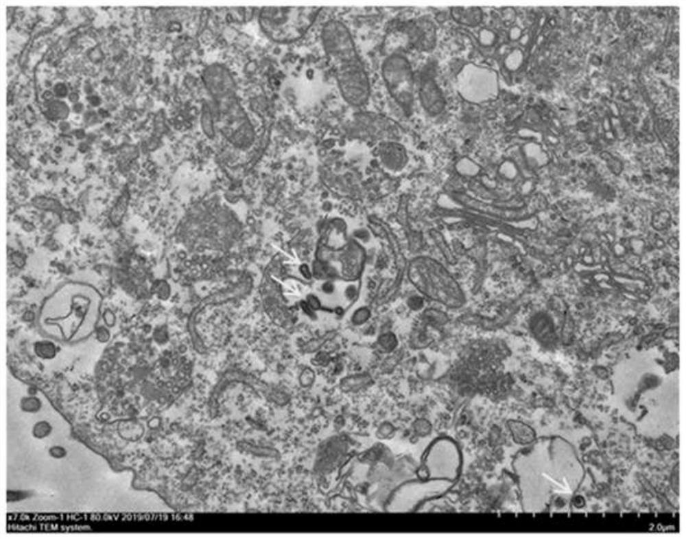 Separation and culture method for Lawsonia intracellularis