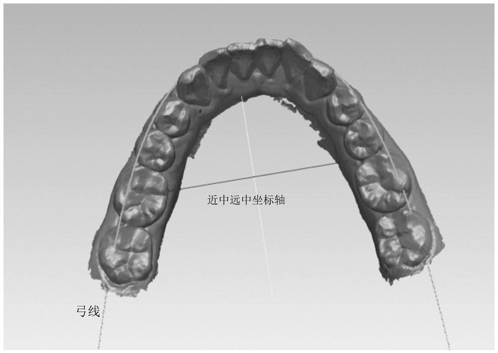 Oral cavity detection method and device based on artificial intelligence, electronic equipment and medium