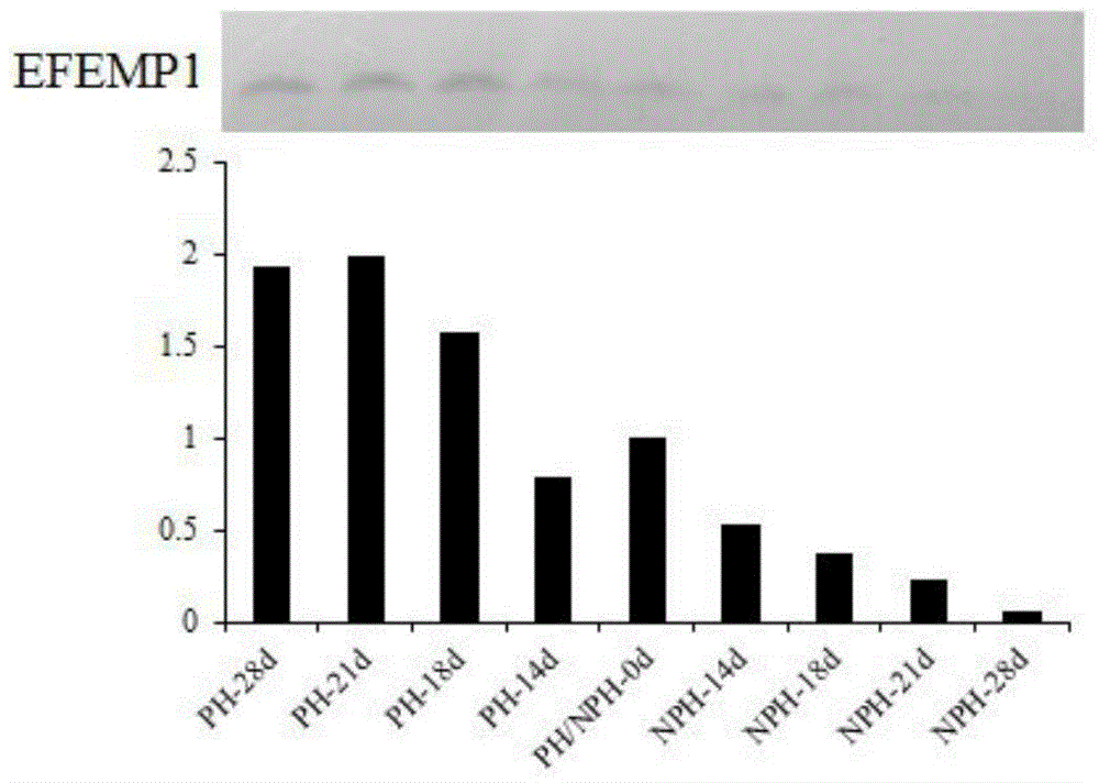 Differential protein in serum at early pregnancy stage of cow and application of differential protein