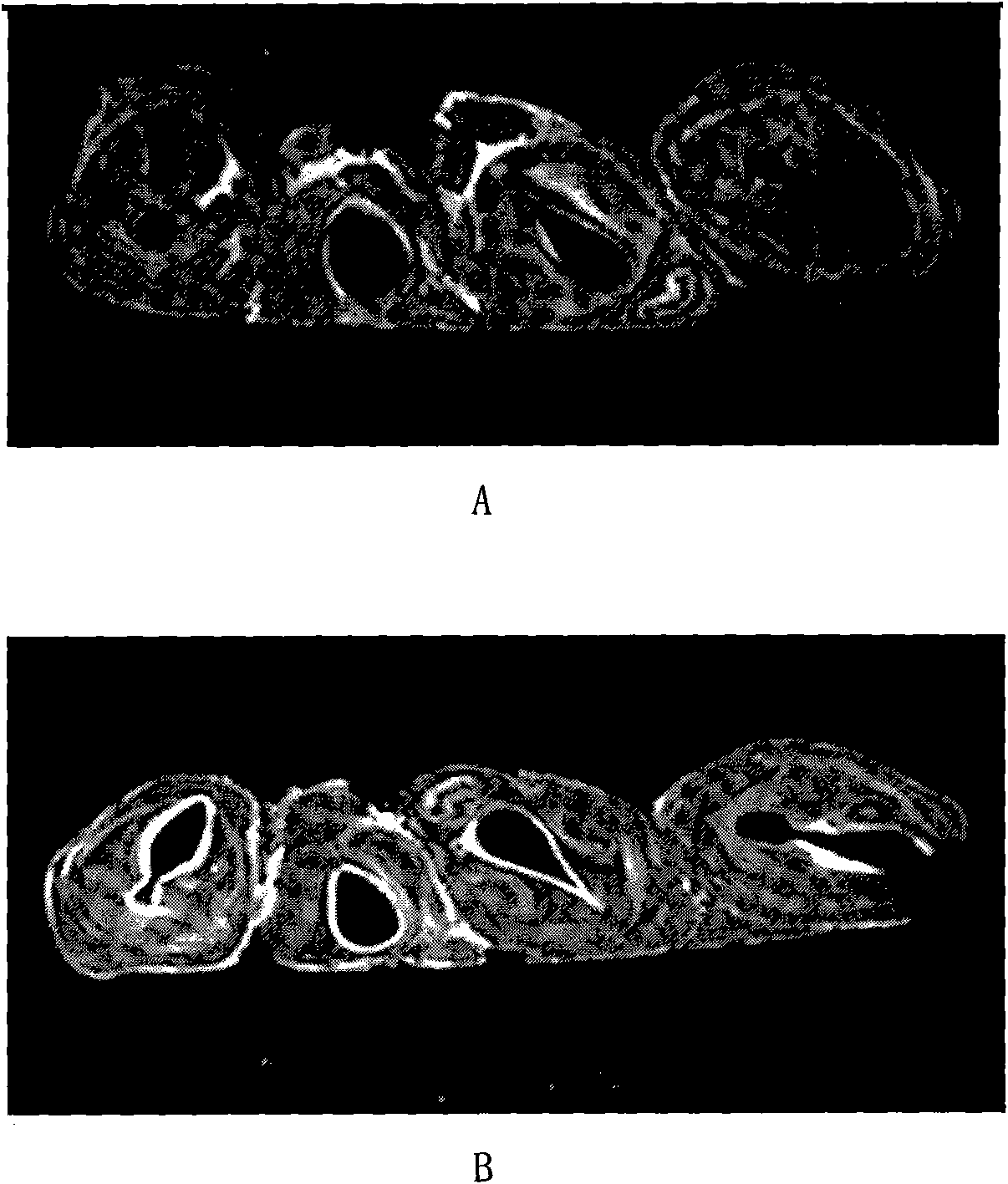 Respiratory-tract magnetic-resonance spray contrast agent and preparation method thereof