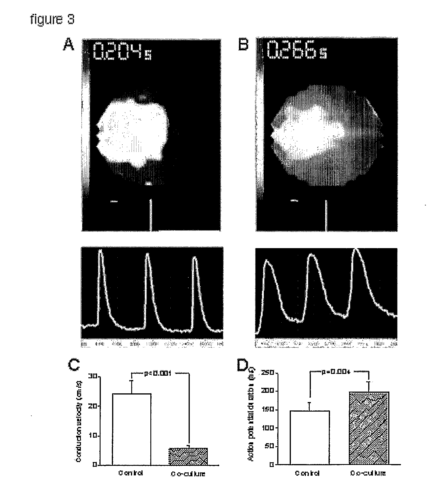 Preventing Arrhythmias Associated with Cell Transplantation