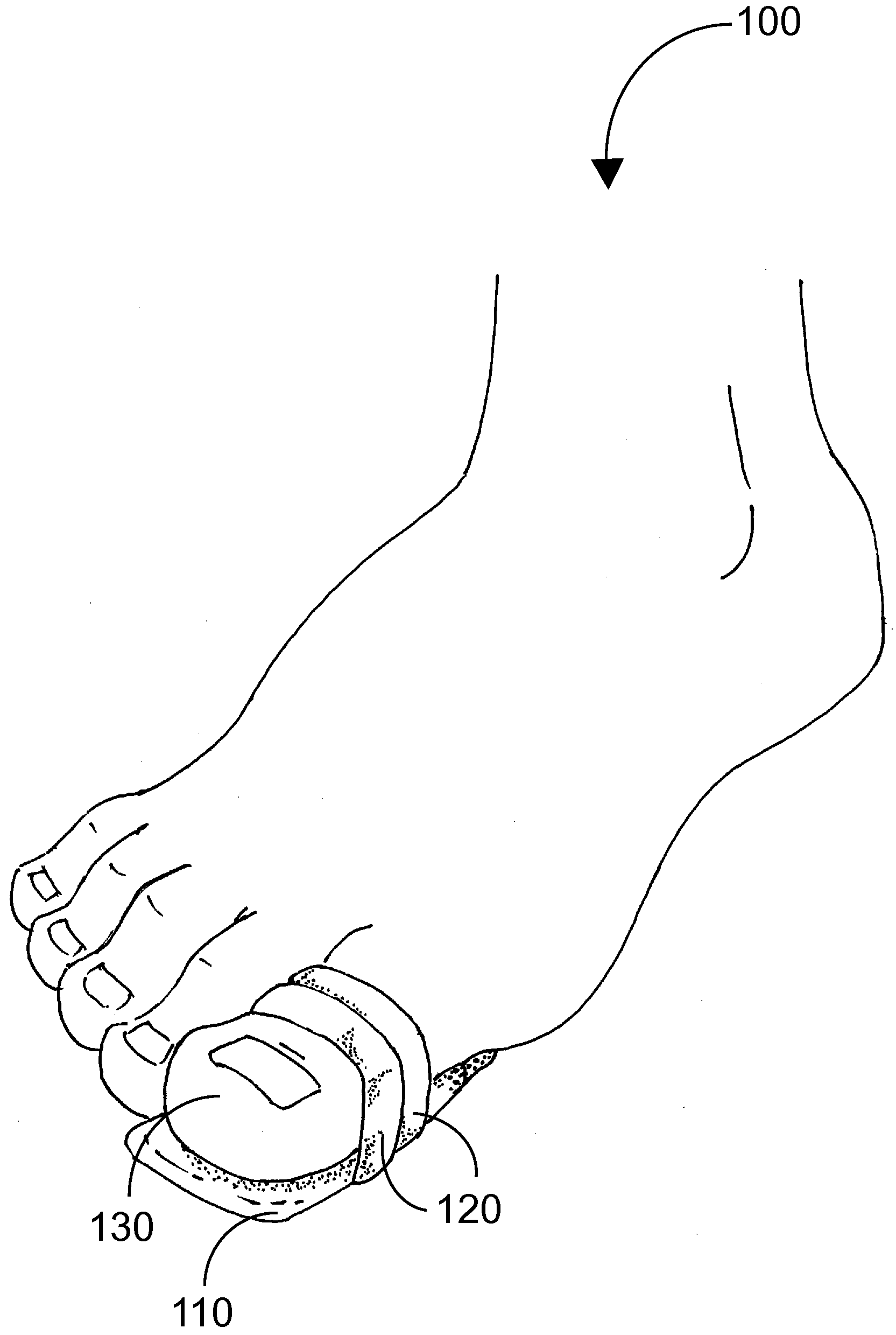 Toe protecting device