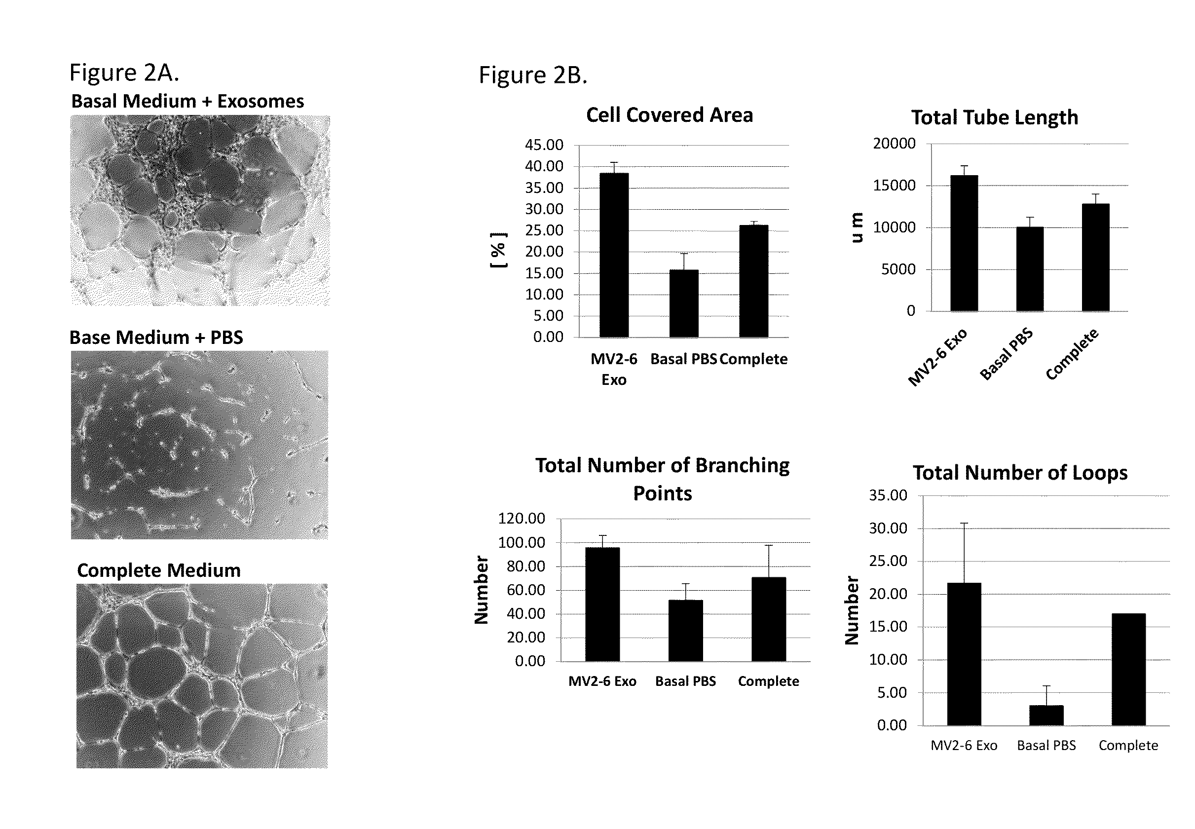 Exosomes from clonal progenitor cells