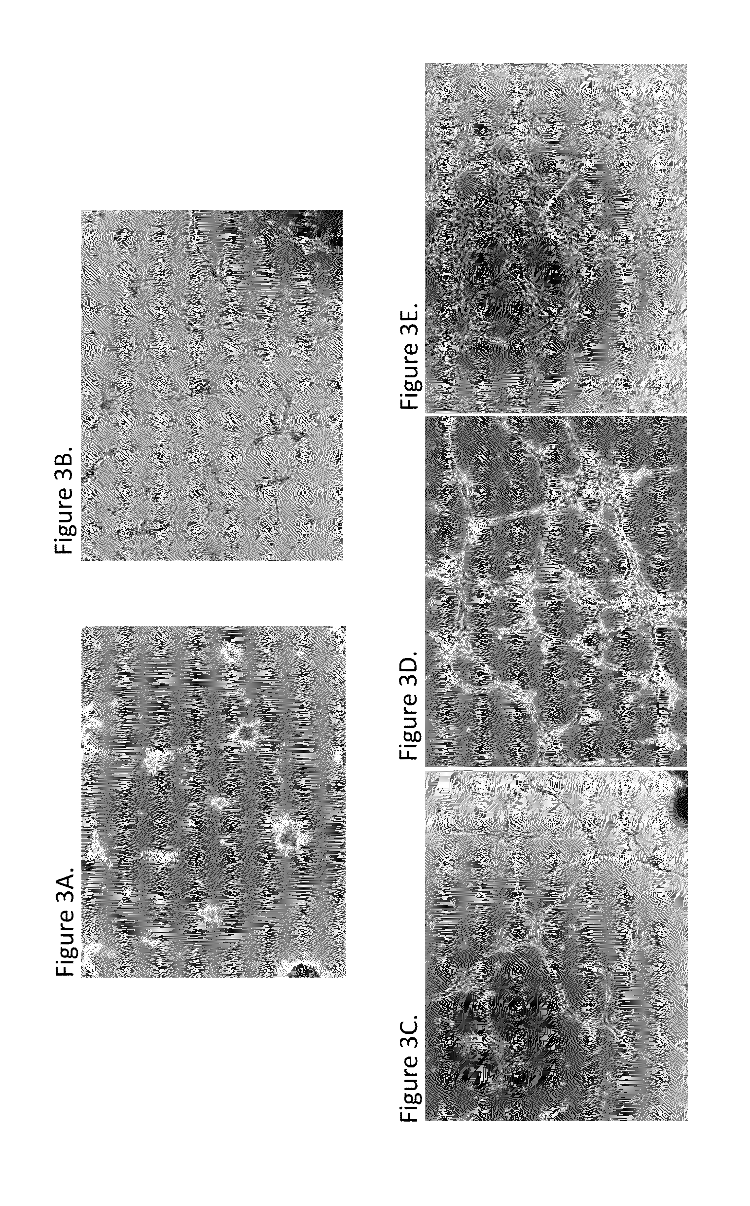 Exosomes from clonal progenitor cells