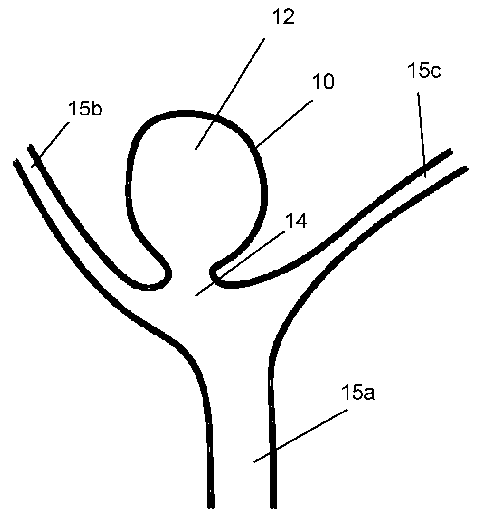 Aneurysm closure device