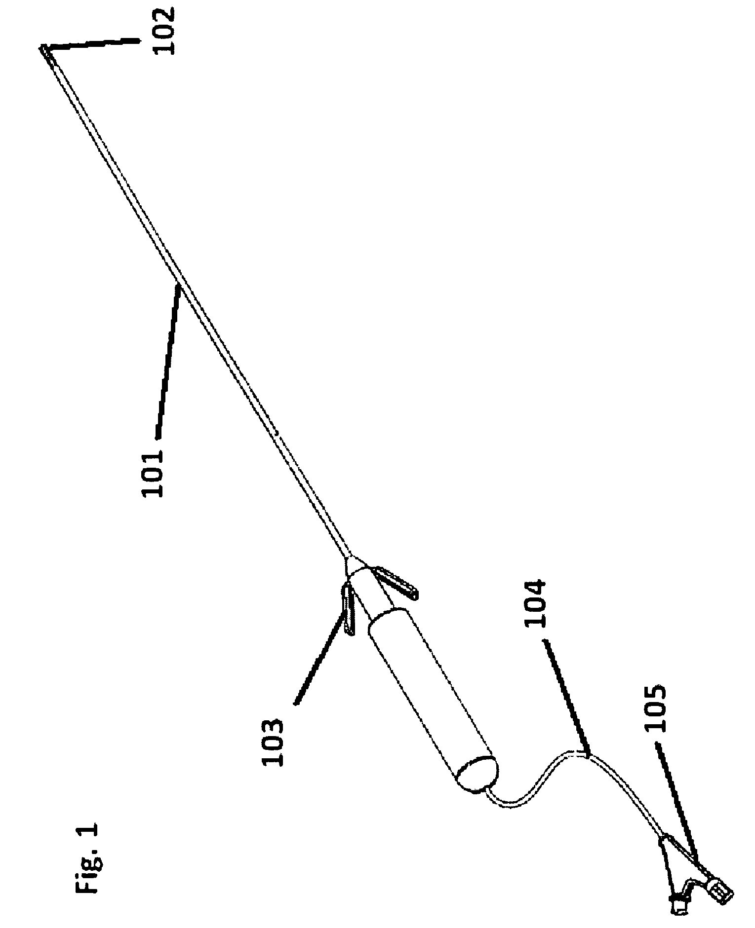 Retrievable urethra sparing prosthetic stent and kidney stone intervention system