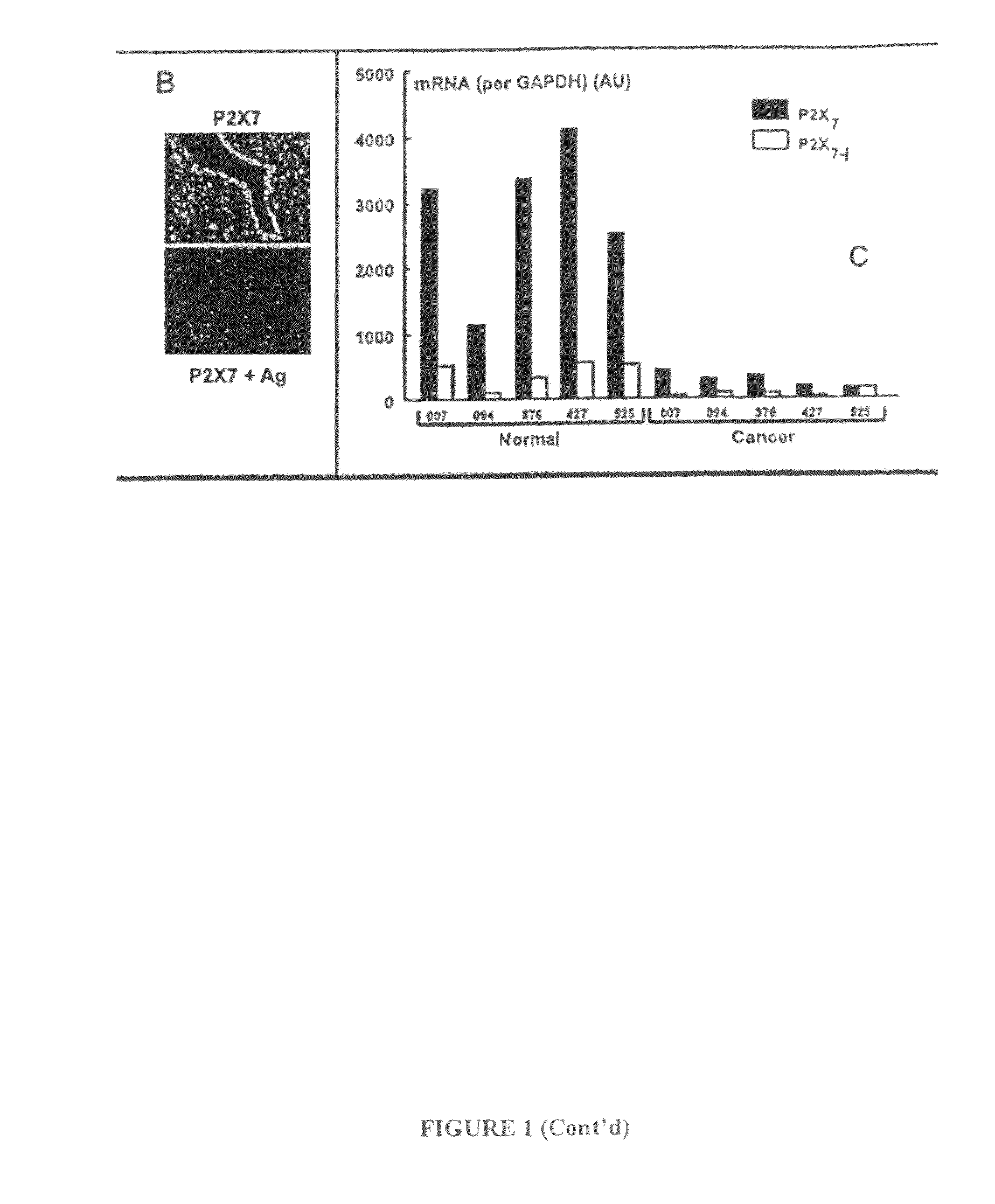 Screening, diagnosing, treating and prognosis of pathophysiologic status by RNA regulation