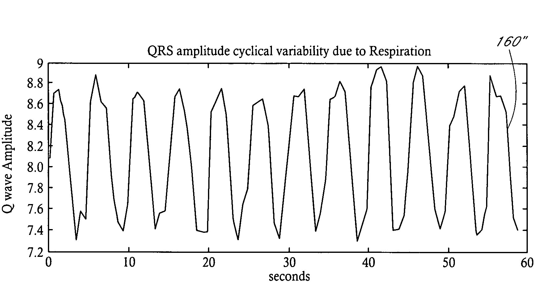 Implantable cardiac stimulation device with respiratory modulated therapy delivery