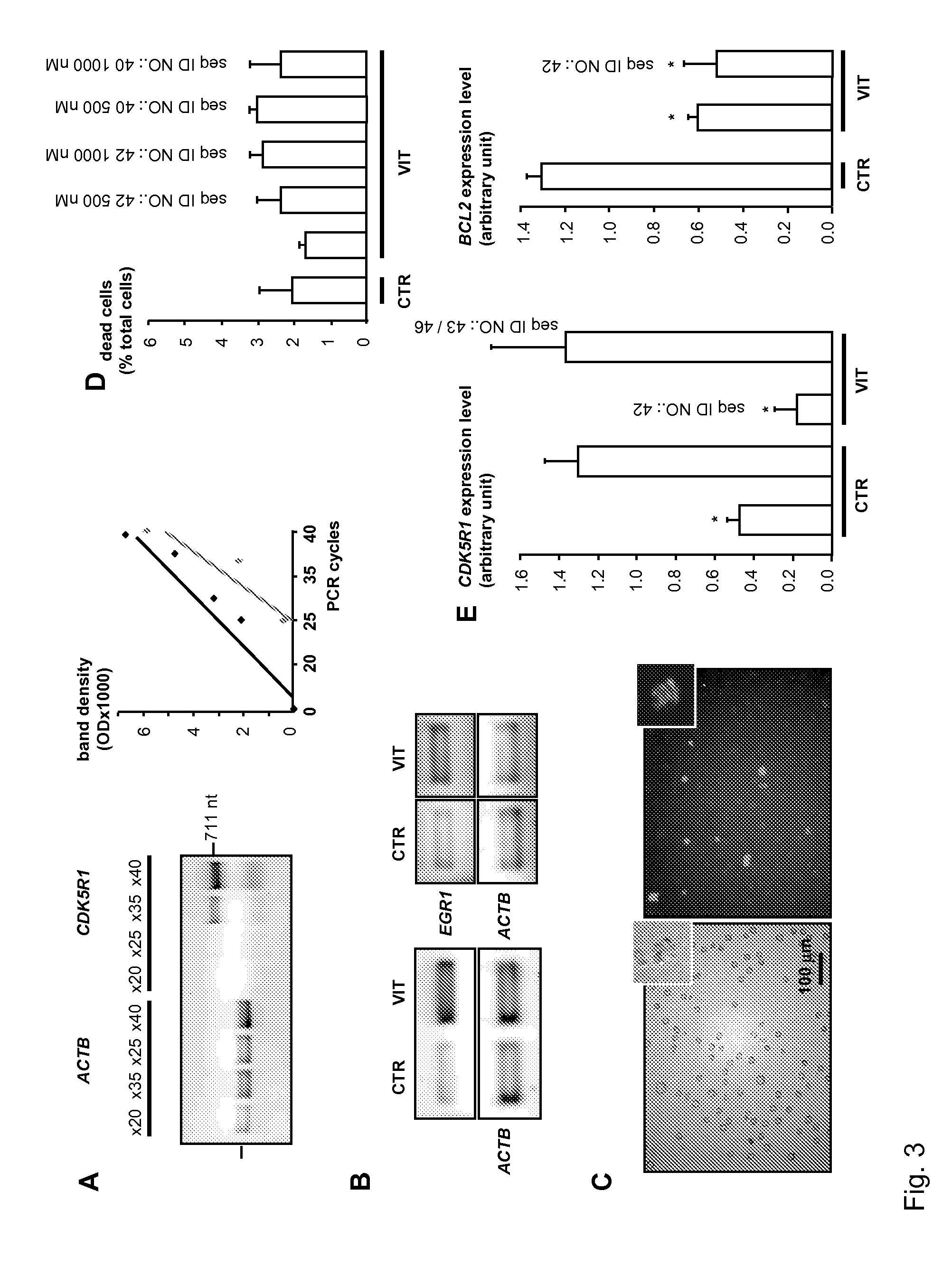 Gene expression and pain