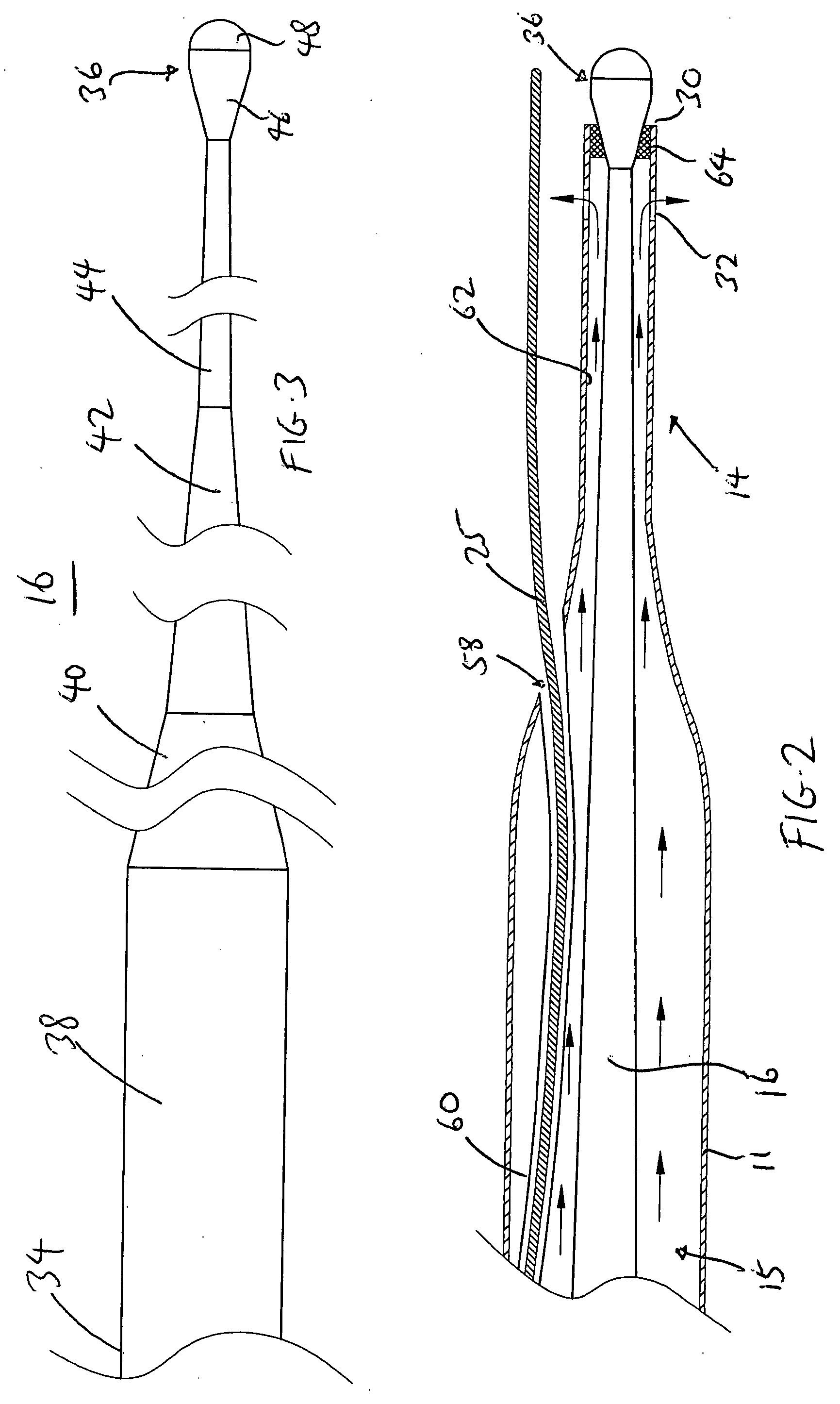 Ultrasound catheter having protective feature against breakage