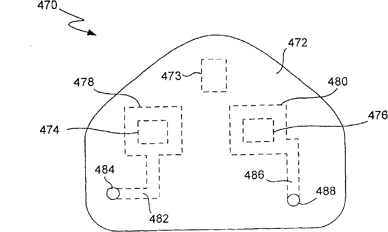 Compact power adapter, electronic device, power adapter and method for assembling power adapter