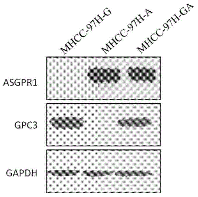 Dual-targeting genetically modified immunologic effector cell aiming at GPC3 (Glypican-3) and ASGPR1 (asialoglycoprotein receptor 1) and applications of dual-targeting genetically modified immunologic effector cell