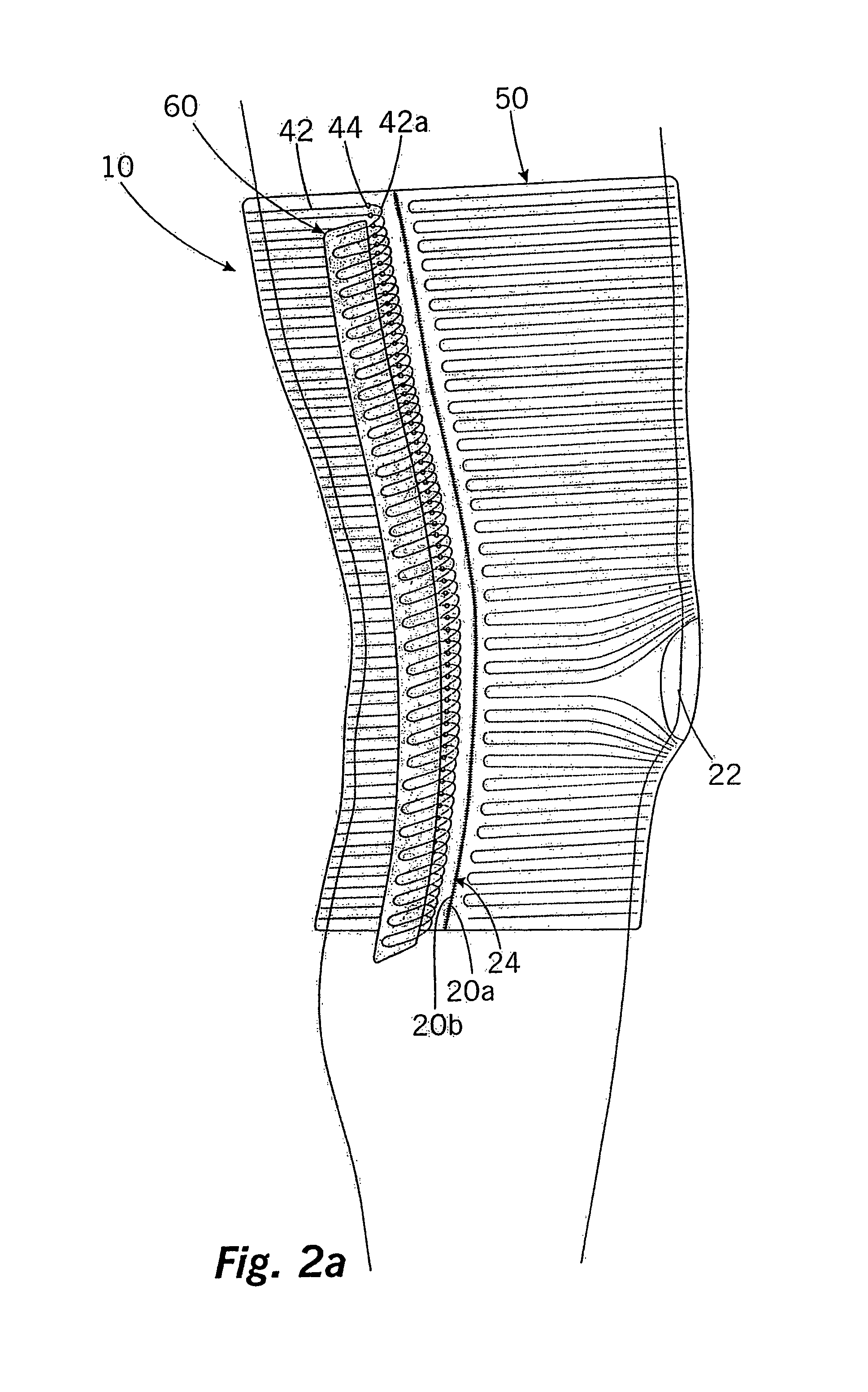 Compression bandage and method for its manufacture