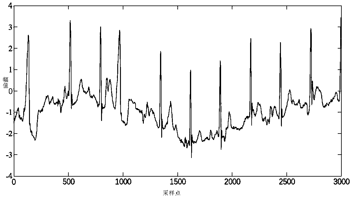 A method for automatic noise reduction of ECG signals