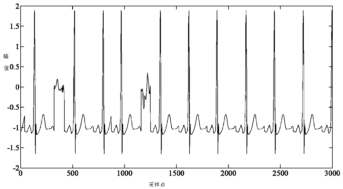 A method for automatic noise reduction of ECG signals