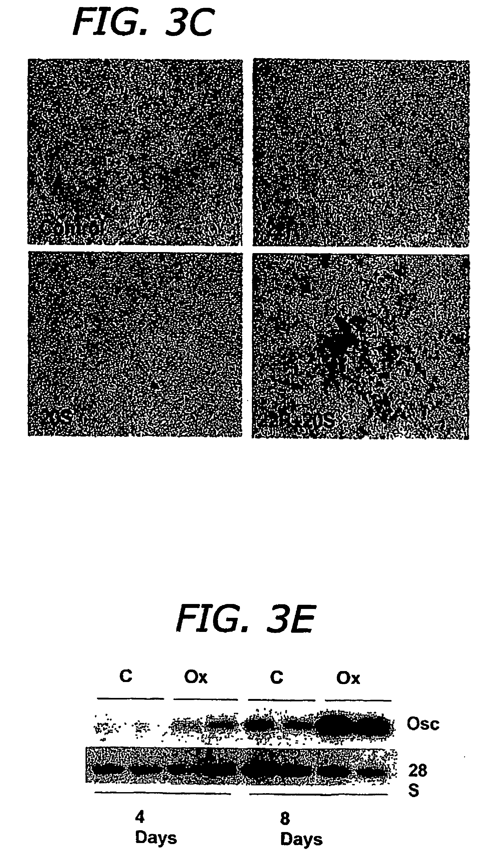 Agents and methods for enhancing bone formation