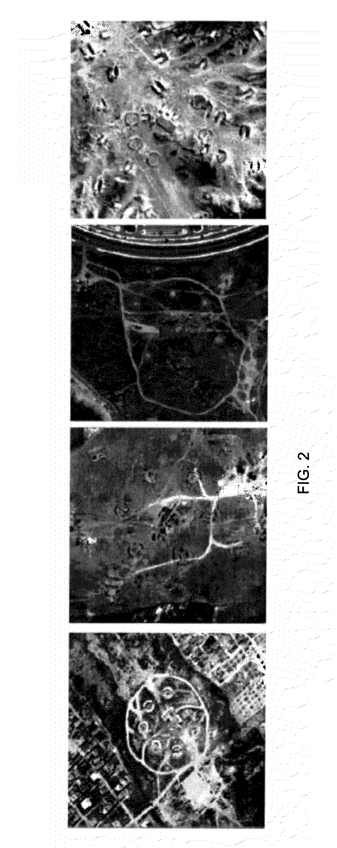 Predicate logic based image grammars for complex visual pattern recognition