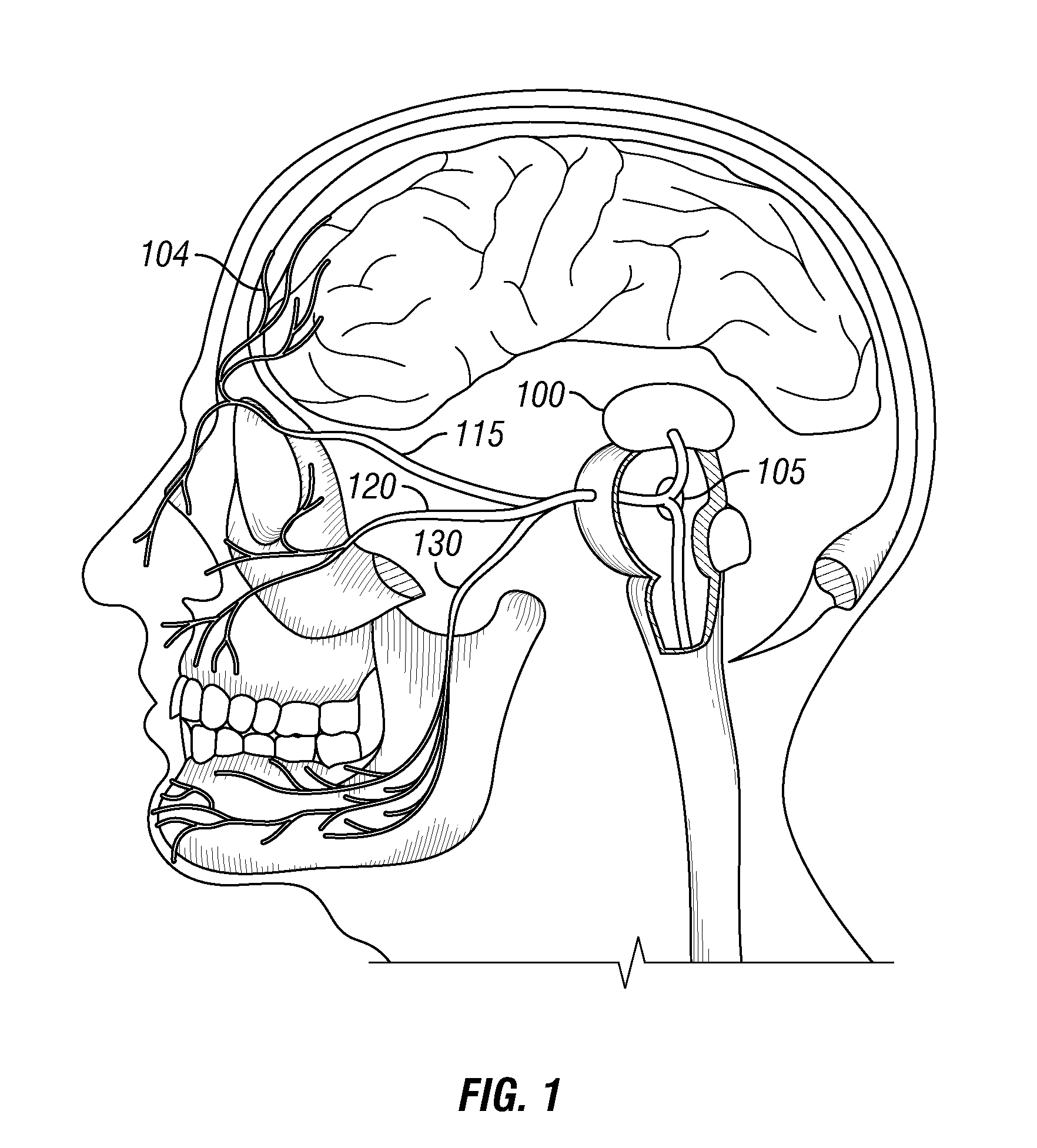 Methods using trigeminal nerve stimulation to treat neurological diseases