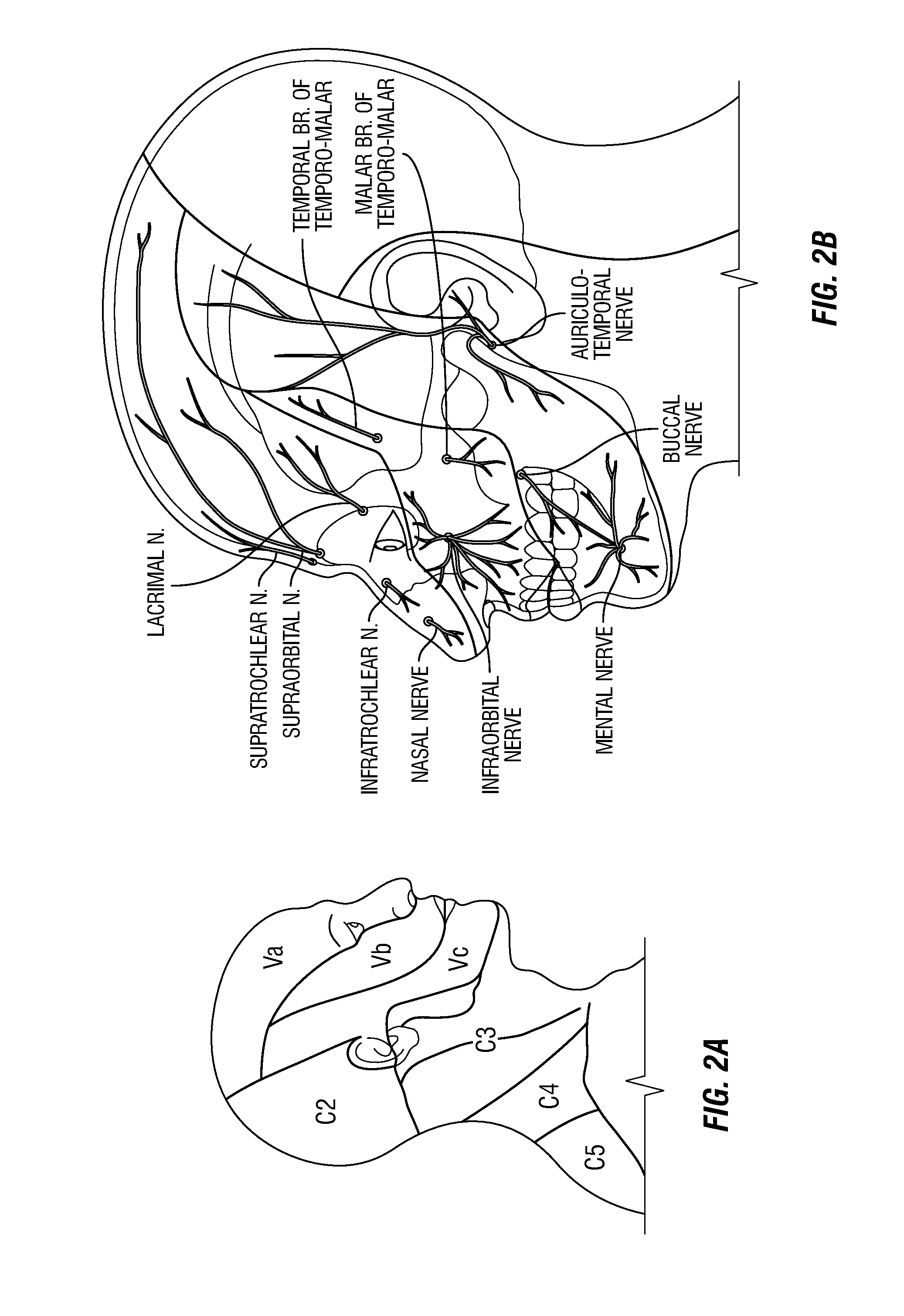 Methods using trigeminal nerve stimulation to treat neurological diseases