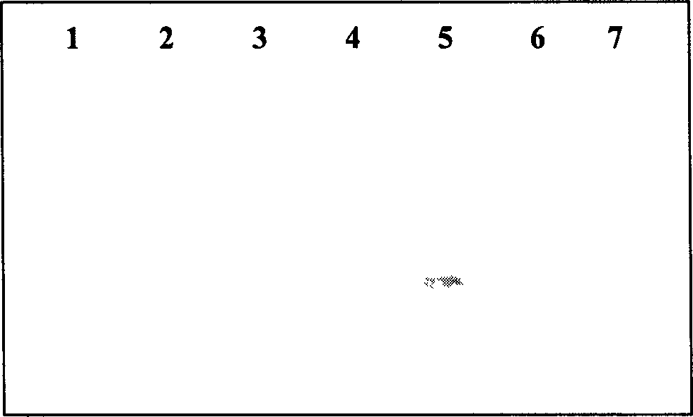 CR1 gene related to cell reconstitution, conduction and death