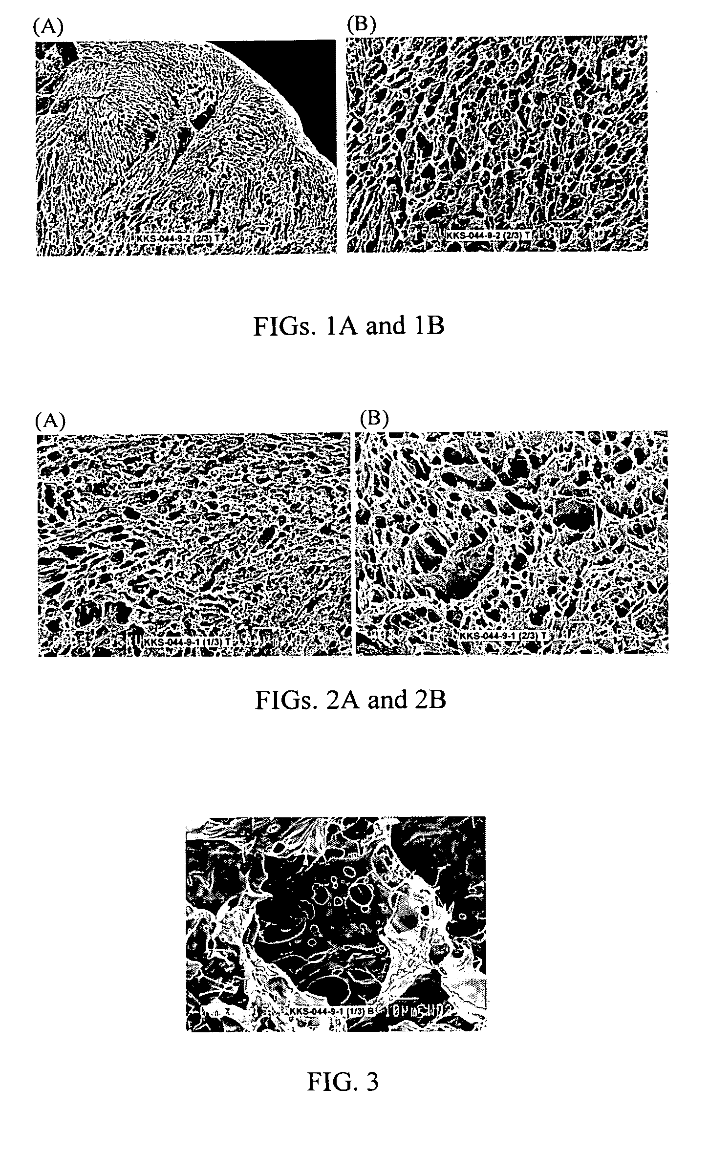 Bioabsorbable implant of hyaluronic acid derivative for treatment of osteochondral and chondral defects