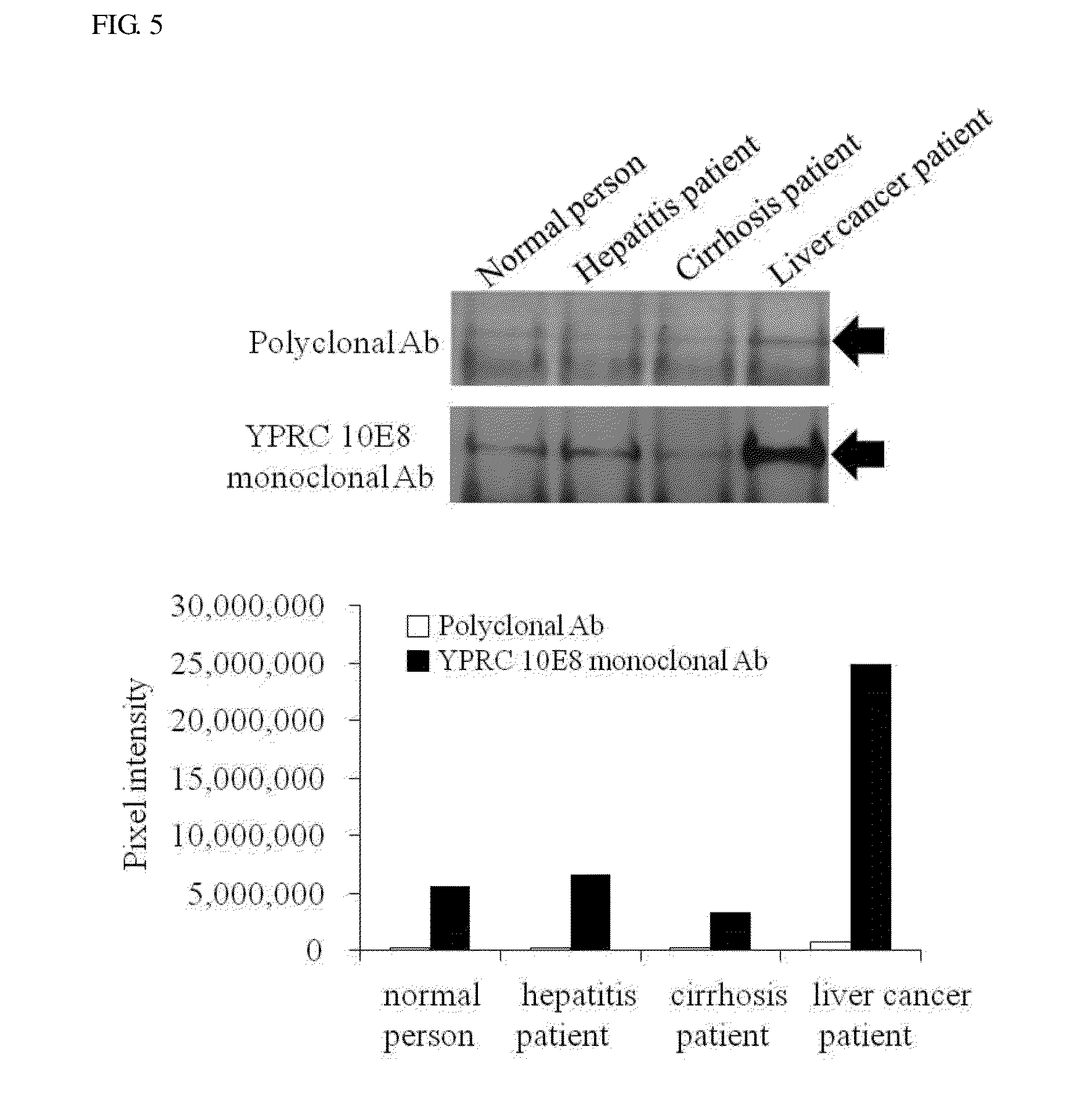 Monoclonal Antibodies which Specifically Recognize Human Liver-Carboxylesterase 1, Hybridoma Cell Lines which Produce Monoclonal Antibodies, and Uses Thereof