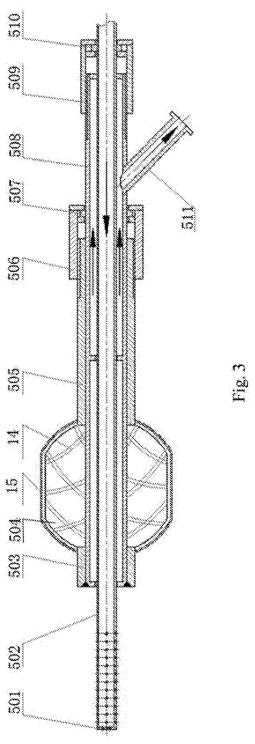 Ultrasonic Thrombus Removing System