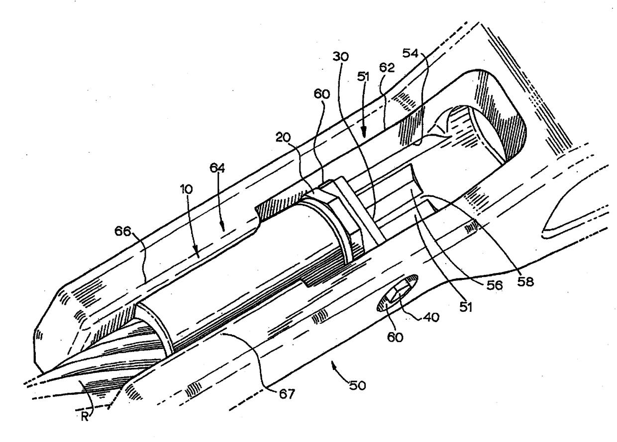 Ferrule Retention