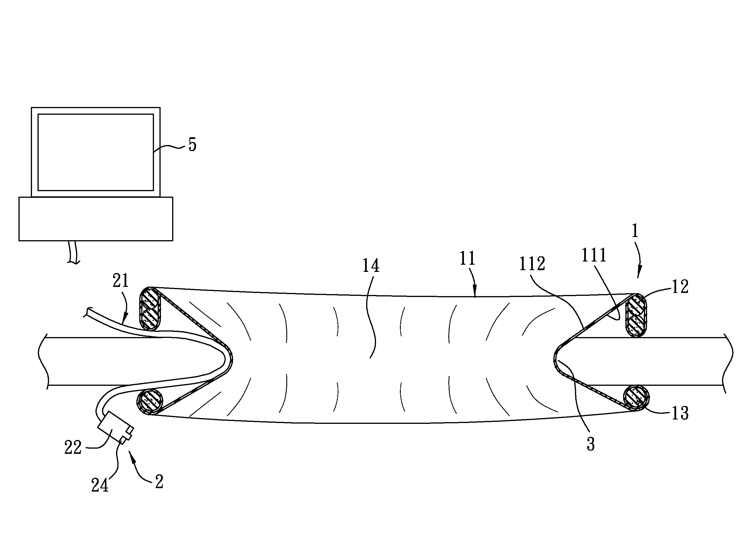 Combined retractor and endoscope system