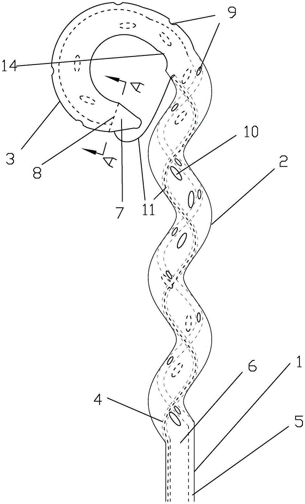 Loop type nasal biliary flushing tube