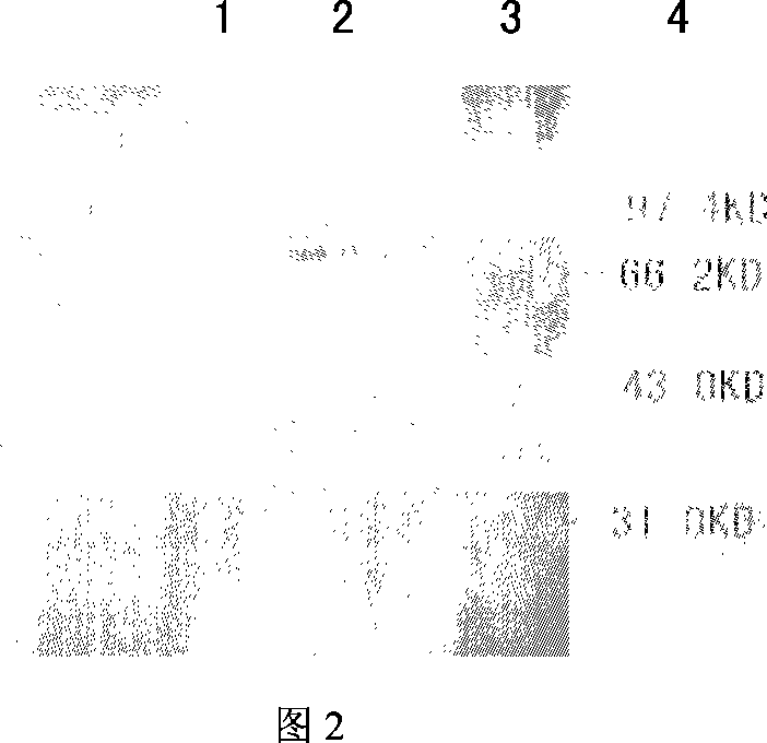 Derivational expression method of glucose polycytidylate enzyme in expression system of lactobacillus casei