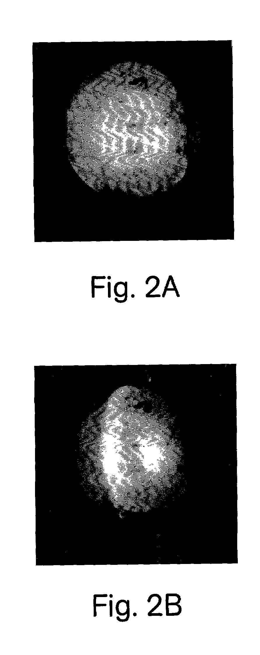 Methods for diagnosing a neurodegenerative condition