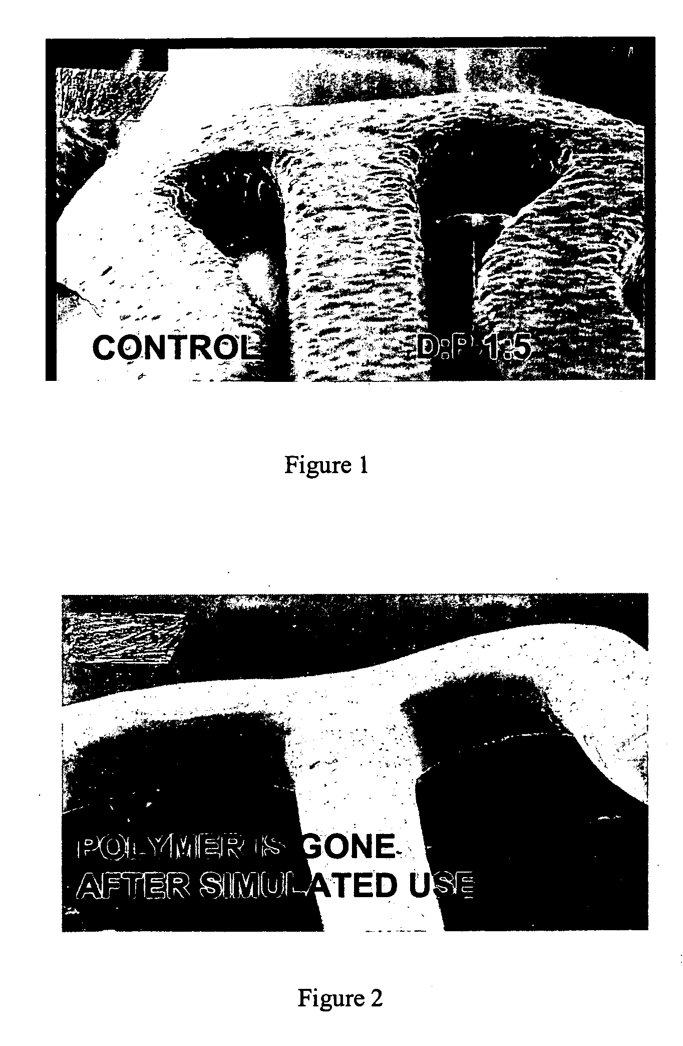 Coating of fast absorption or dissolution