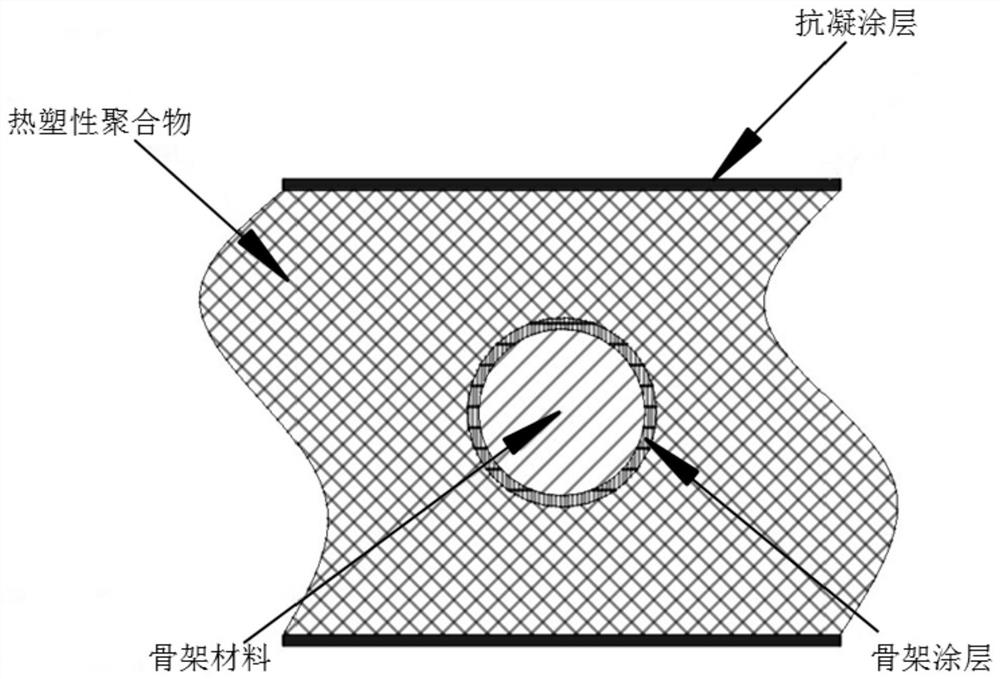 Covered implantable medical device and preparation method thereof