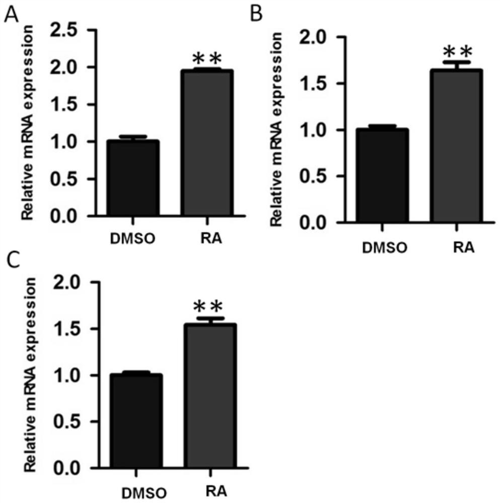 A method for inducing directional differentiation of pluripotent stem cells into cardiomyocytes