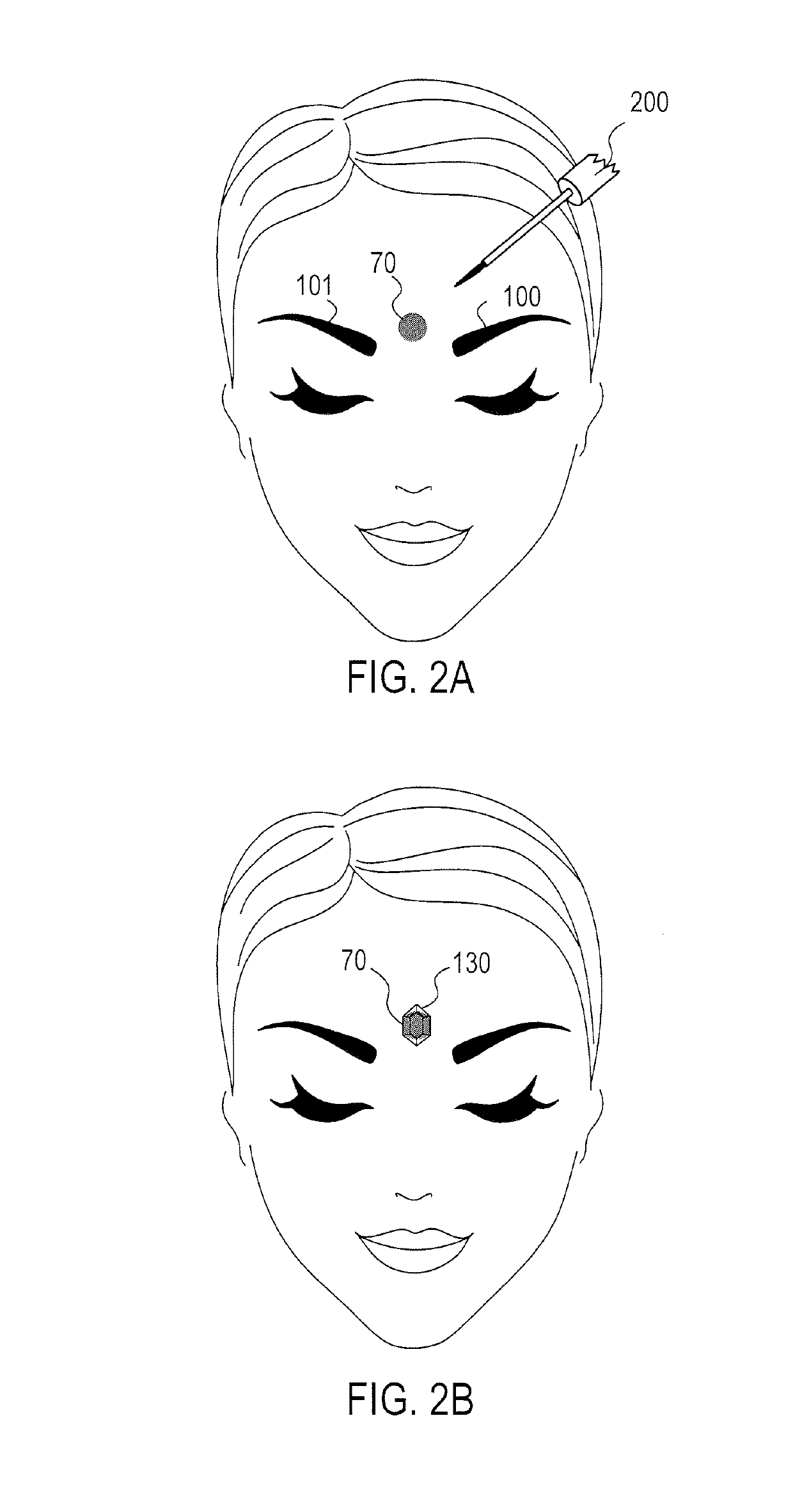 Magnetic dermal adhesives, accessories, and related methods