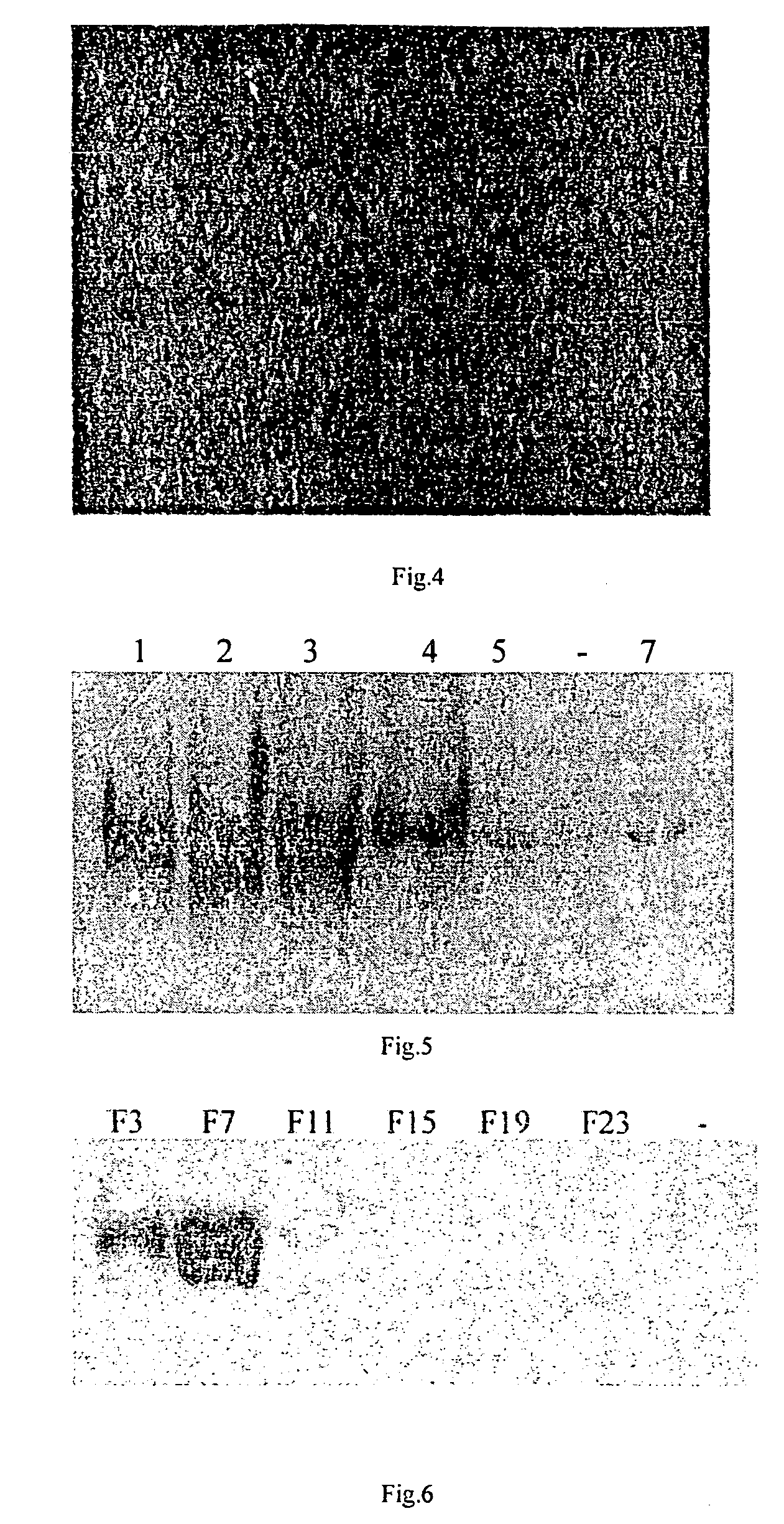 Human source leading sequence, gene vector and gene expression strategy