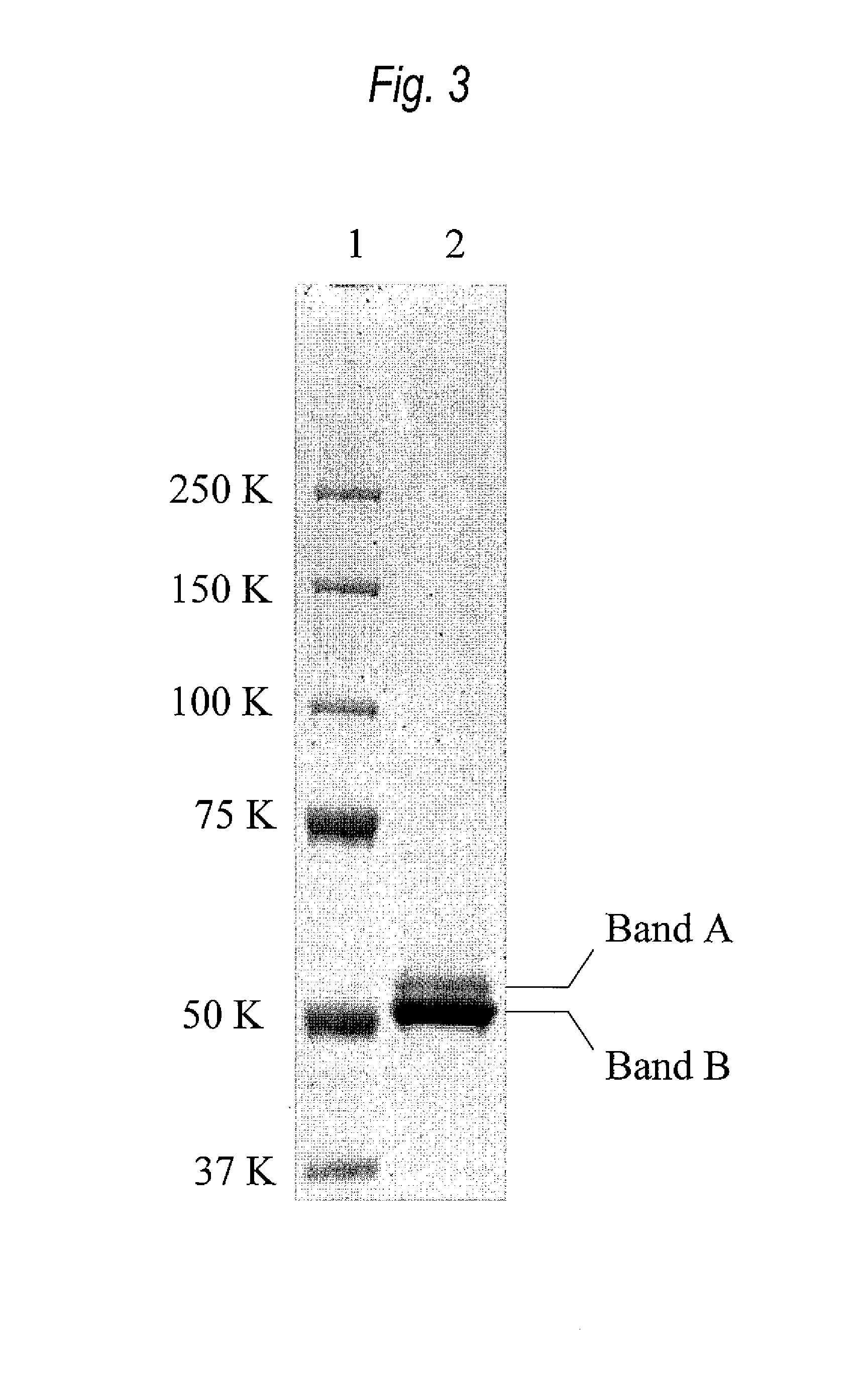 Antibody variants composition