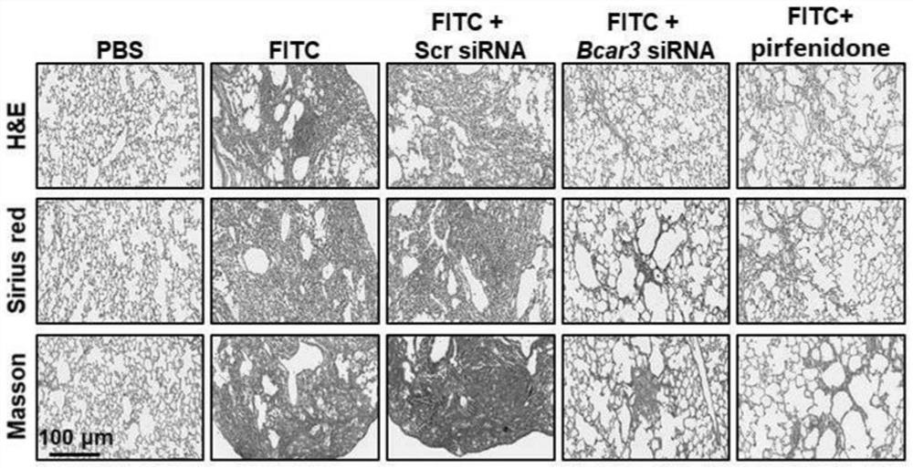 BCAR3 inhibitors and their use in prevention and treatment of fibrotic diseases