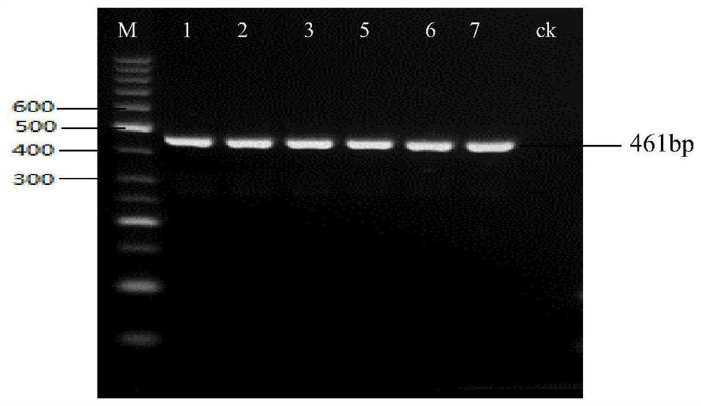 Application of ncoa1 gene snp site and its kit