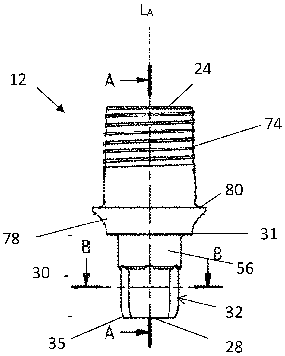 Implant system