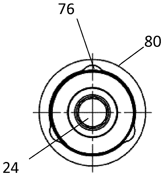 Implant system