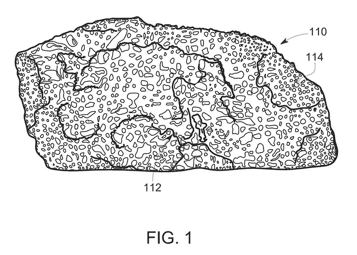 Compressed decalcified trabecular bone grafts and tooth socket repair