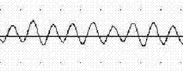 Method for measuring electrophysiological activity of colon muscles of mice