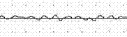 Method for measuring electrophysiological activity of colon muscles of mice