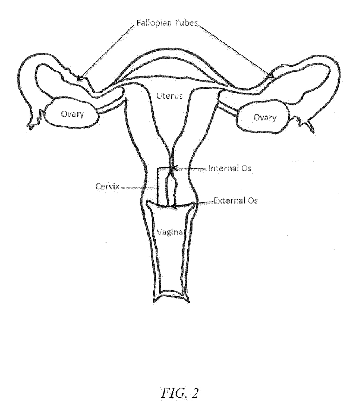 Device for sterile uterine sampling and drug delivery