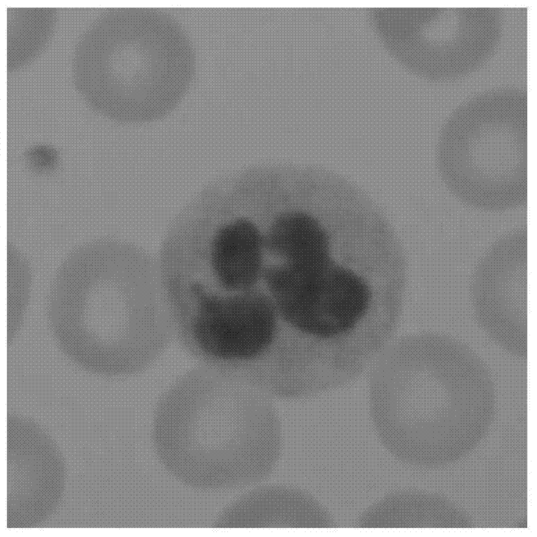 Boundary-based white cell segmentation evaluation standard establishment method